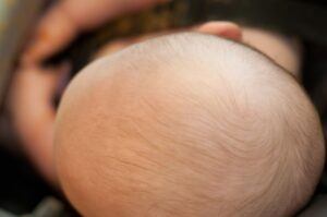 bayi rambut gugur atasi dengan minyak rambut