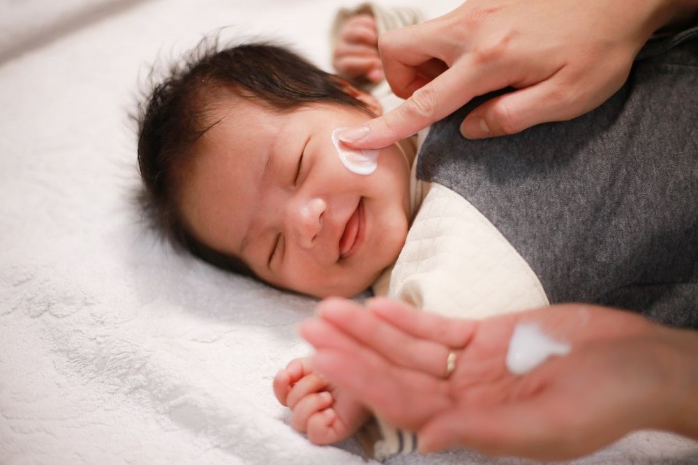 gunakan krim muka untuk elak bintik putih di muka bayi